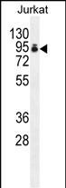 WB - PAP Antibody (Center) AP11691c